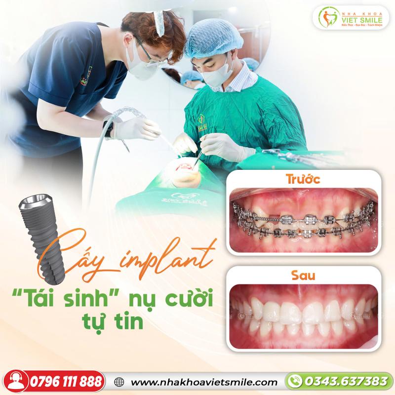 Nha khoa Việt Smile
