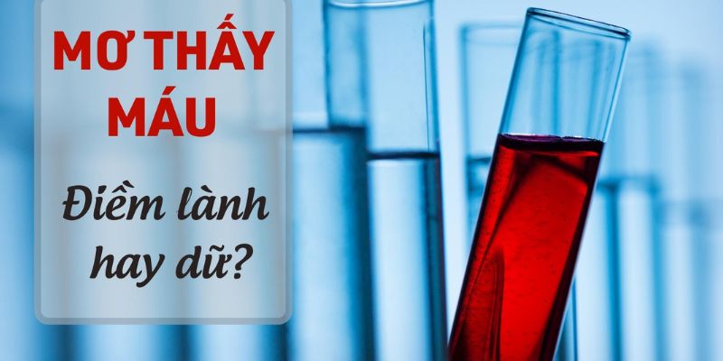 Nằm Mơ Thấy Máu Đánh Con Gì An Toàn Húp Bạc Tỷ Về Túi? 3 Nằm mơ thấy máu đánh con gì vào bờ an toàn trúng lớn?